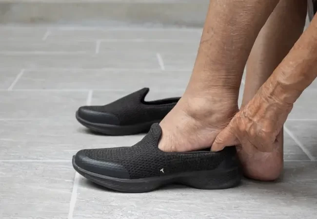 Your Diabetic Shoes Have an Expiry Date – Here's How to Know It's Time