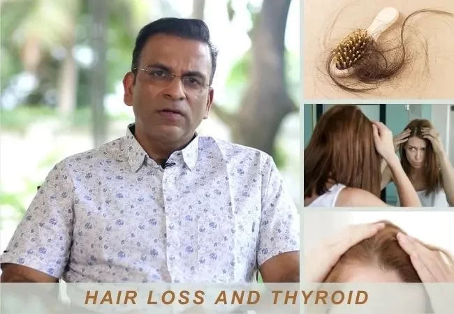 Thyroid Hair Loss