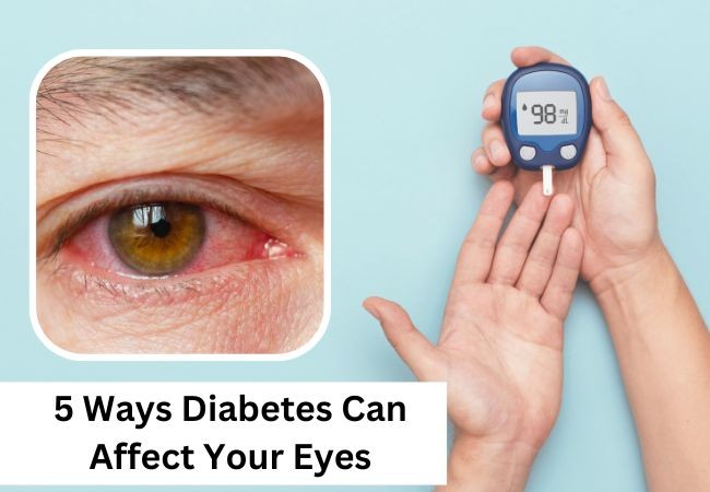 Diabetes Can Affect Your Eyes