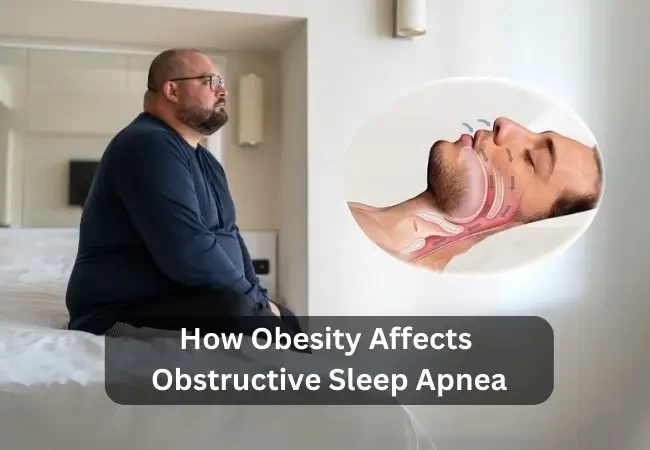 How Obesity Affects Obstructive Sleep Apnea