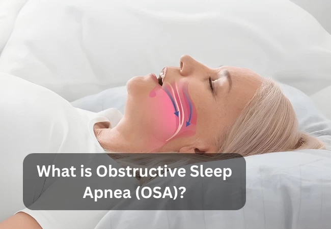 What is Obstructive Sleep Apnea